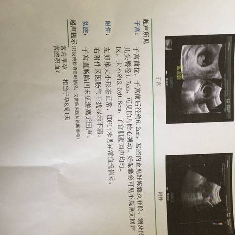 journal_insert_pic_996133553