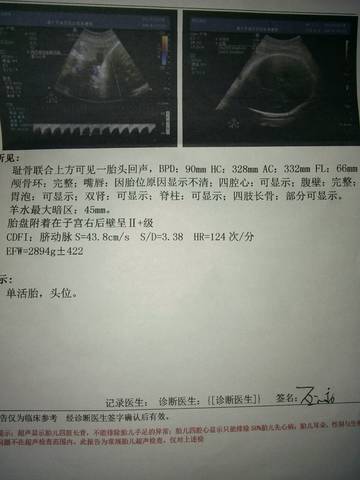 journal_insert_pic_997395444