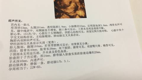 journal_insert_pic_997228531