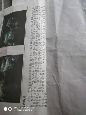 journal_insert_pic_999022736