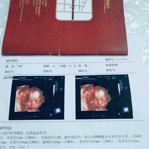 journal_insert_pic_999086492