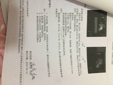 journal_insert_pic_999829279