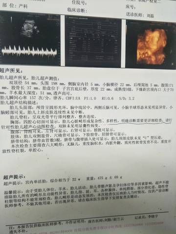 journal_insert_pic_999363499