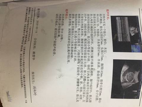 journal_insert_pic_999829258