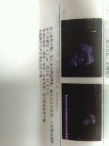 journal_insert_pic_1000456923