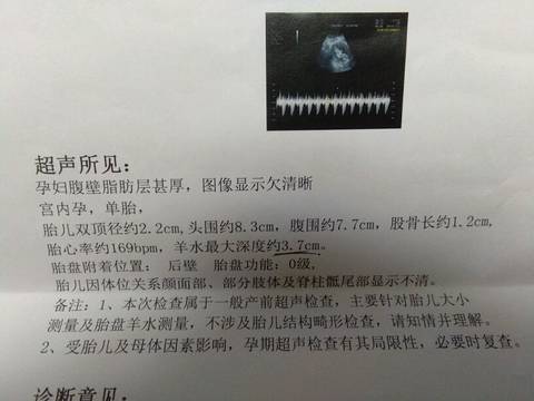 journal_insert_pic_1000456933
