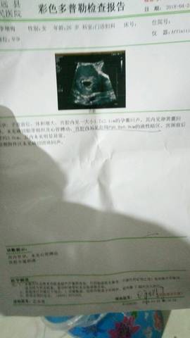 journal_insert_pic_1000840269
