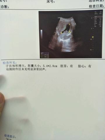 journal_insert_pic_1001696180