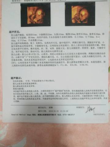 journal_insert_pic_1002812725