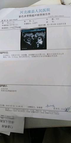 journal_insert_pic_1003613935