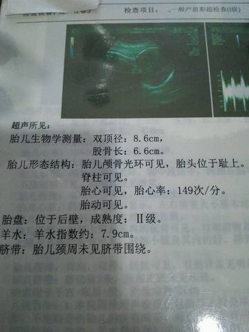 journal_insert_pic_1003287037
