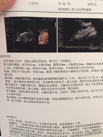 journal_insert_pic_1004027590