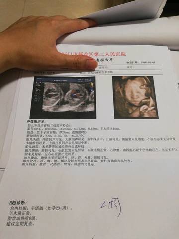 journal_insert_pic_1005853866