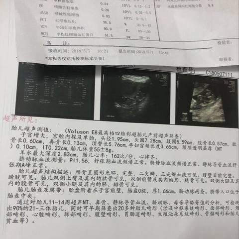 journal_insert_pic_1006445651
