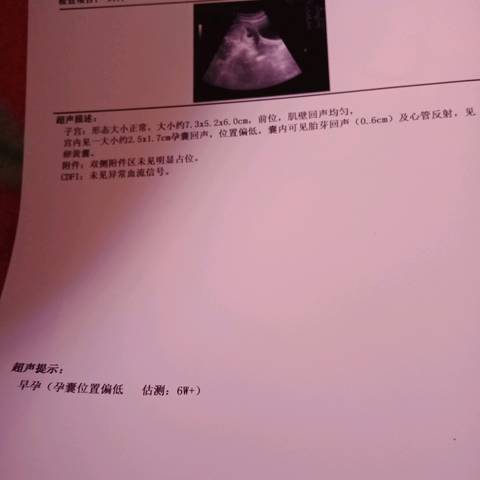 journal_insert_pic_1006698633