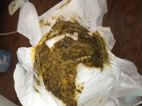 那天我给她转了下奶粉,这几天都是母乳的,然后今天拉出的便便黄黑色的