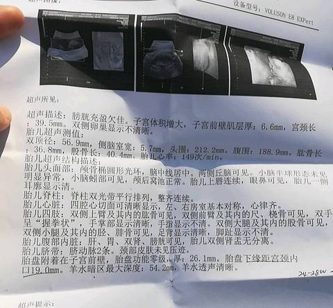 journal_insert_pic_1009031298