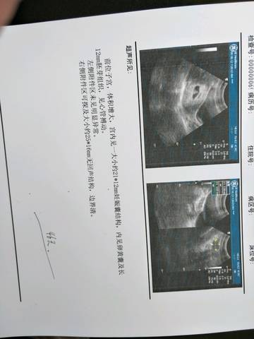 journal_insert_pic_1008697971