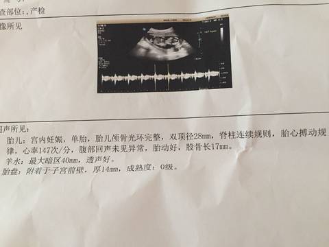 journal_insert_pic_1009217395