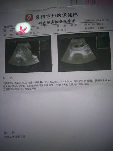 journal_insert_pic_1013799321
