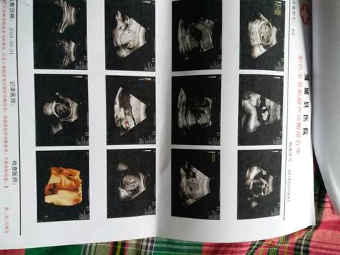 journal_insert_pic_1016476236
