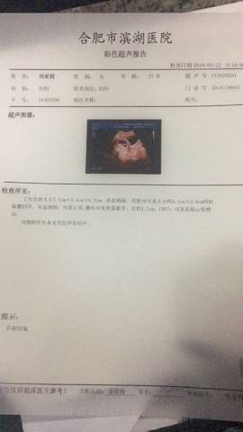 journal_insert_pic_1017025401
