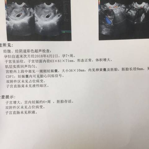 journal_insert_pic_1018688314