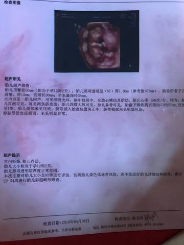 journal_insert_pic_1020827871