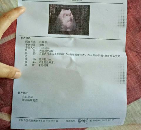 journal_insert_pic_1021700449