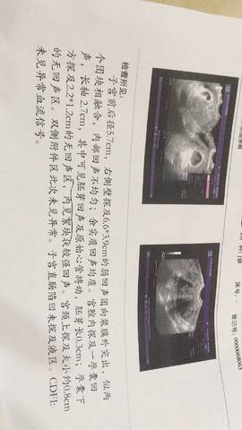 journal_insert_pic_1021530742