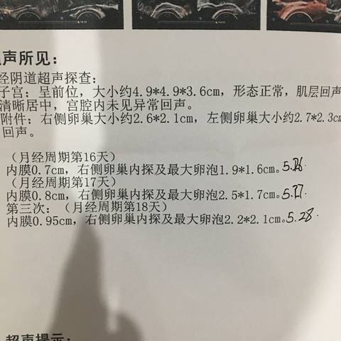 journal_insert_pic_1022083405