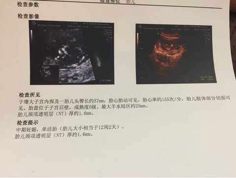 journal_insert_pic_1021808547