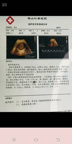 journal_insert_pic_1022663933