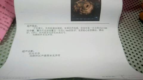 journal_insert_pic_1023224346