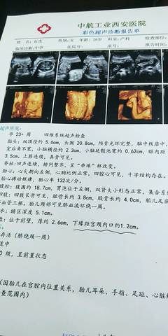 journal_insert_pic_1023236536
