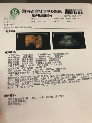 journal_insert_pic_1023232519