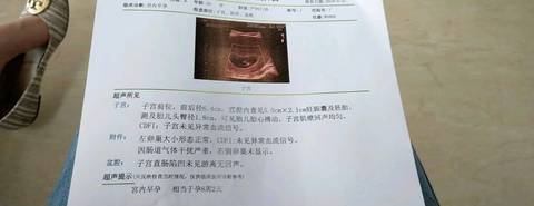 journal_insert_pic_1024148091