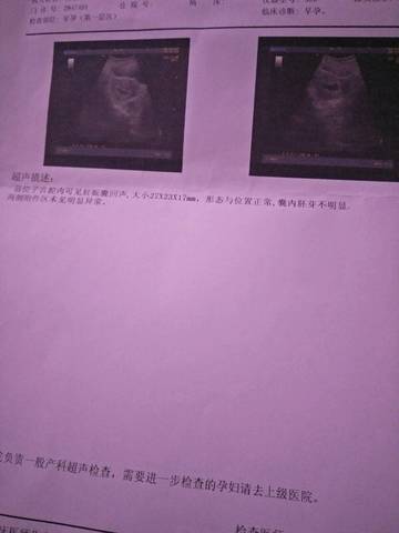 journal_insert_pic_1024535077