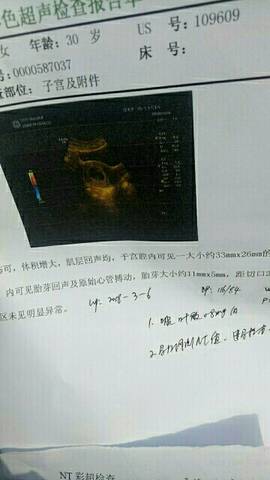 journal_insert_pic_1024983651