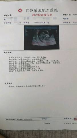 journal_insert_pic_1024770241