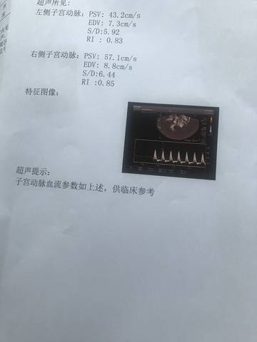 journal_insert_pic_1025696794