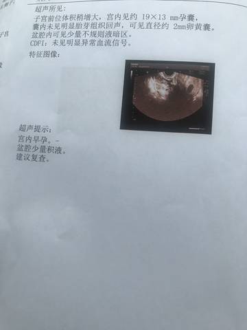 journal_insert_pic_1025696782