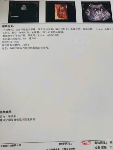 journal_insert_pic_1025726471