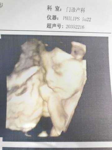 journal_insert_pic_1027241402