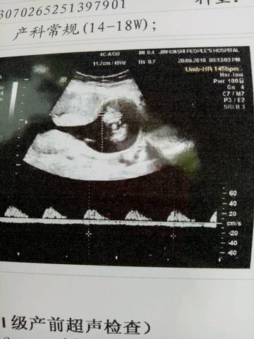 journal_insert_pic_1028229250