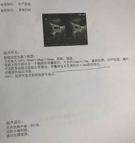 journal_insert_pic_1028386066