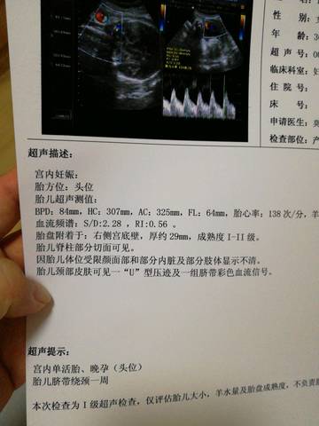 journal_insert_pic_1029747549