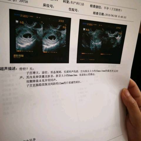 journal_insert_pic_1030075674