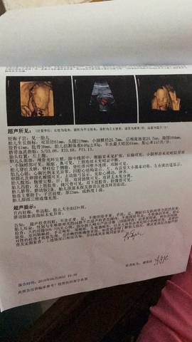 journal_insert_pic_1030253562