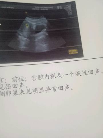 journal_insert_pic_1030183585